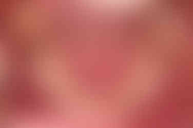 부산치아교정비용