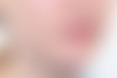 부산개방교합