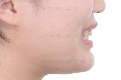 부산치아교정치과