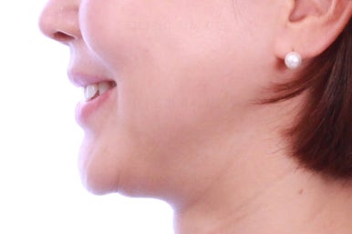 연산동부분교정