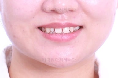 부산치아교정치과