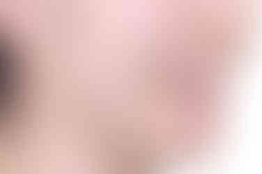 부산부분치아교정