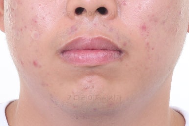 부산교정치과