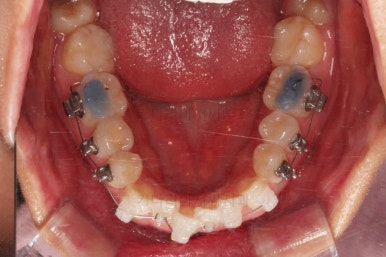 부산교정잘하는치과