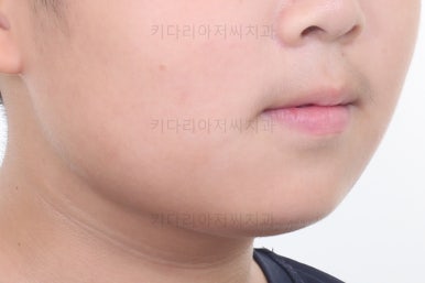 부산어린이교정
