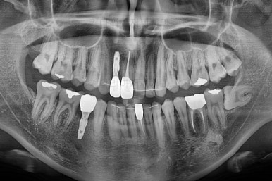 연산동치아교정