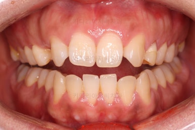 연산동교정치과