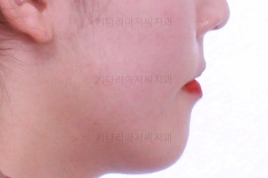 부산교정