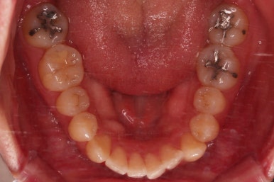 부산치아교정잘하는곳