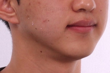 연산동교정전문치과