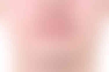 부산비수술교정