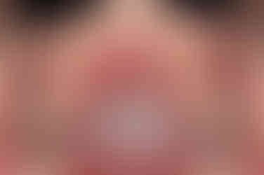 부산어린이치아교정