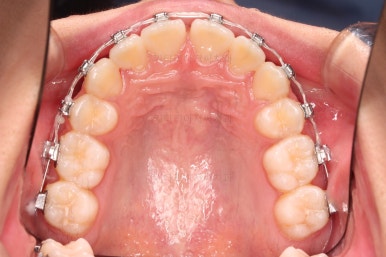 부산치아교정치과