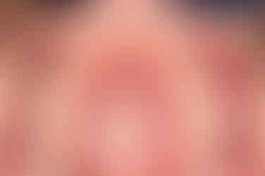 부산치아교정치과