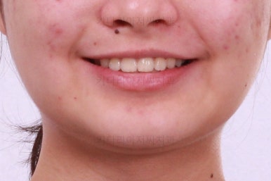 부산치아교정치과