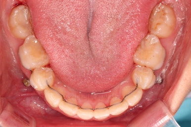 부산무턱교정치과