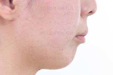 부산무턱교정치과