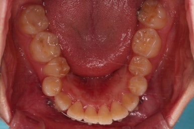 부산무턱교정치과
