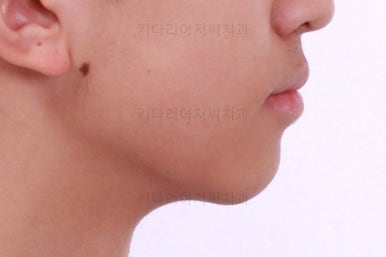 부산교정치과추천