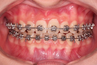 부산청소년교정치과