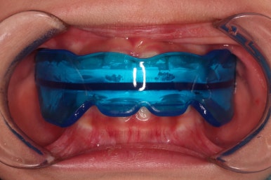 부산어린이교정