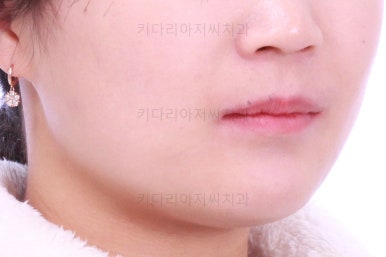 부산치아교정치과