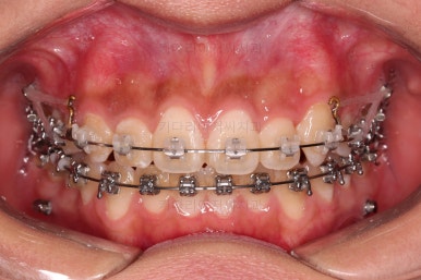 부산치아교정치과