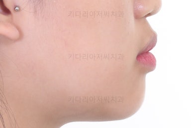 사직동교정치과