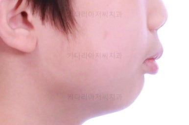 부산어린이교정