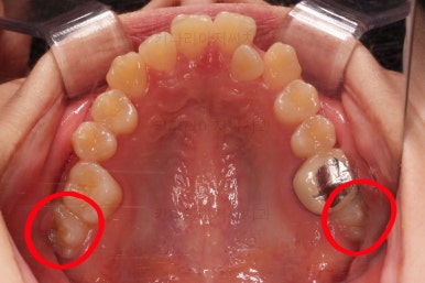 동래구치아교정