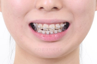 부산무턱교정치과