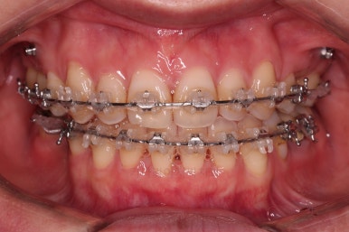 부산재교정치과