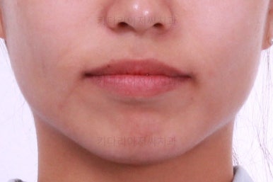 부산연산역치아교정