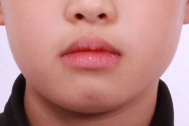 부산어린이교정