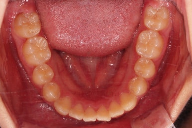 부산교정전문의