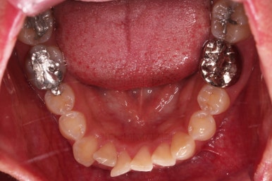 부산안면비대칭