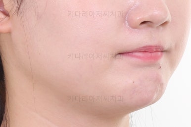 부산인비절라인