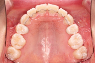 부산치아교정잘하는치과