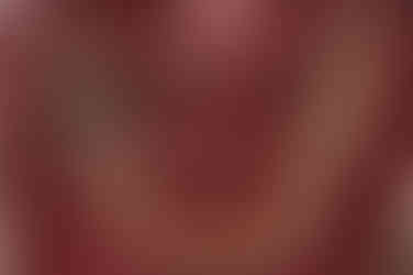 부산토끼치아교정