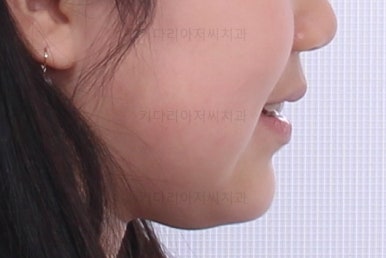 부산초등학생교정