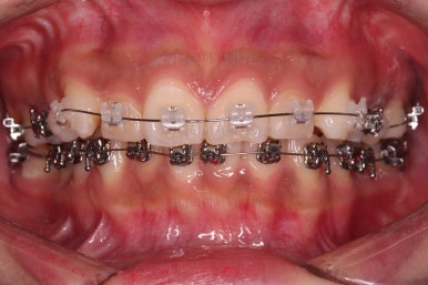 연산동교정치과