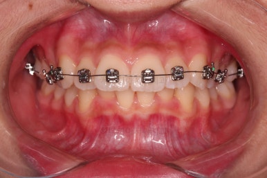 부산치아교정치과