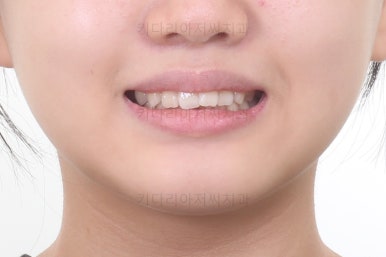 부산교정전문의