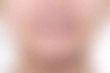 부산교정전문의