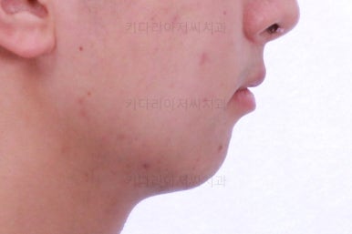 부산교정치과추천