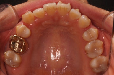 부산인비절라인