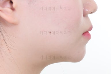 부산교정전문의