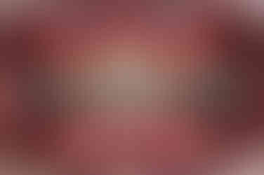 부산비발치교정