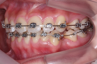 부산교정전문의