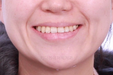 부산연산동치과